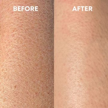 peau sèche avant après gant exfoliant AURAYU