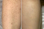 avant apres gant exfoliant soie AURAYU