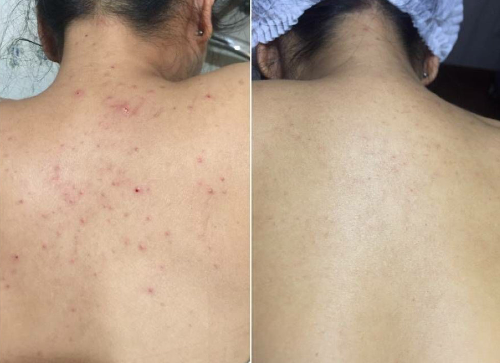 avant apres gant exfoliant soie AURAYU