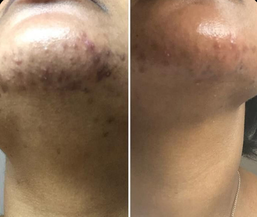 avant apres gant exfoliant soie AURAYU