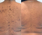 avant apres gant exfoliant soie AURAYU